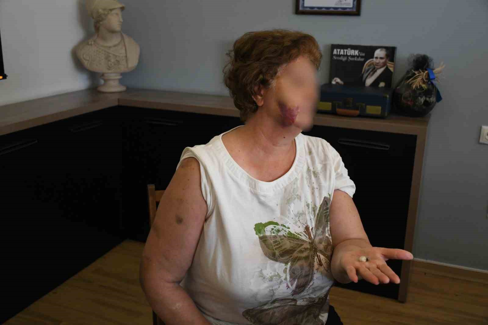 Kuşadası’nda ev kavgası kanlı bitti: Anne ve iki çocuğu bıçaklandı