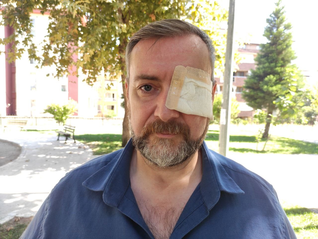 Hem gözünden hem de işinden oldu