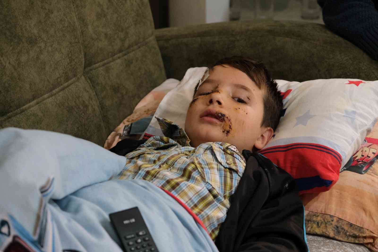 Sokak köpeğinin saldırısına uğrayan çocuk ölümden döndü