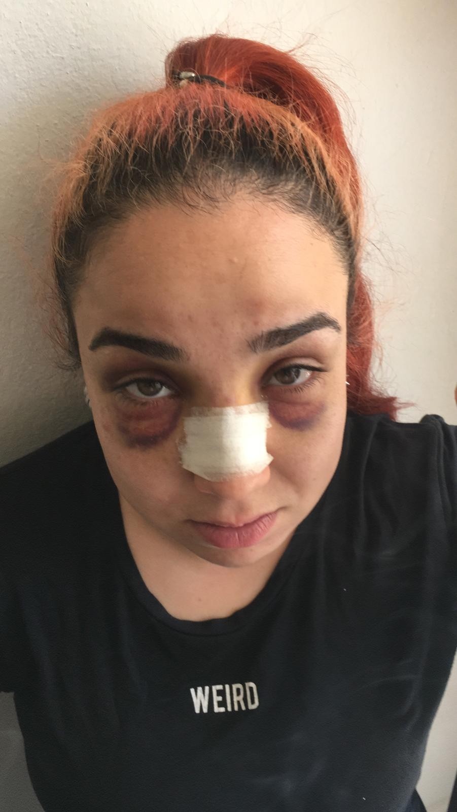 Telefonla konuştuğu için çalışanını darp etti